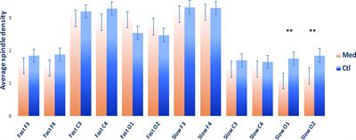 Different Patterns of Sleep-Dependent Procedural Memory Consolidation in Vipassana Meditation Practitioners and Non-meditating Controls
